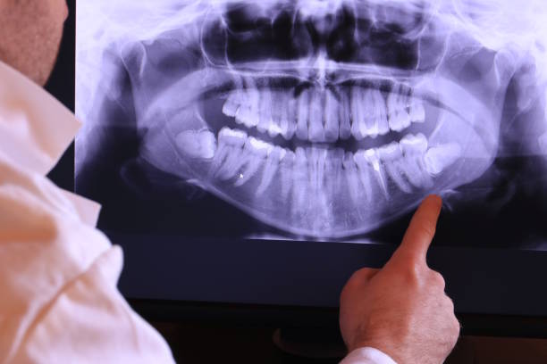 Best Broken or Chipped Tooth Repair in Sutherlin, OR